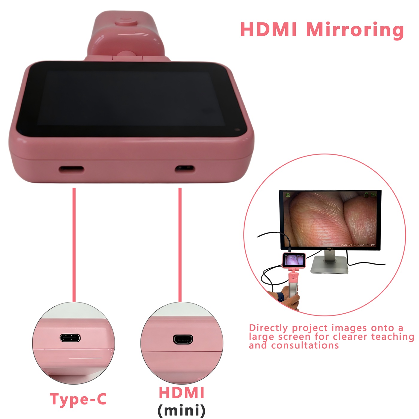 Anestezi için 3,5 inç Dokunmat - Home Cooking Videos incelemesi ve fiyatı